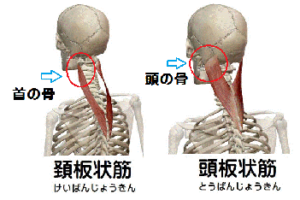 辛い首の骨の痛み それはこの筋肉が原因です 京都市中京区の四条烏丸 平川整体院 針灸治療院